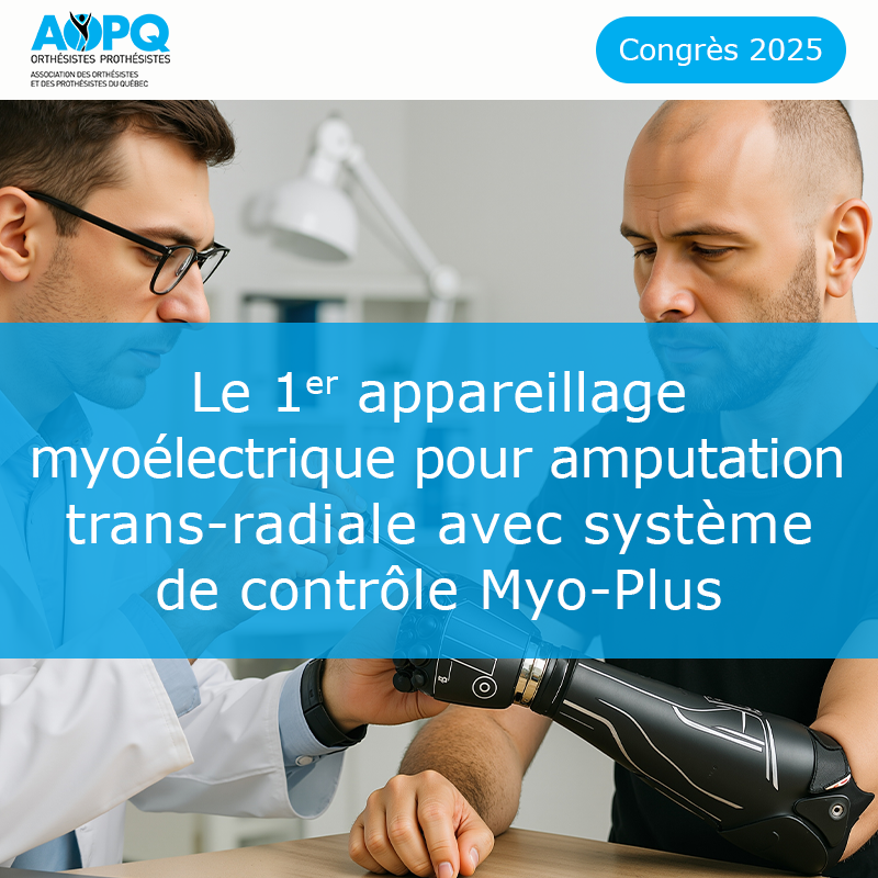 Le 1er appareillage myoélectrique pour amputation trans-radiale avec système de...